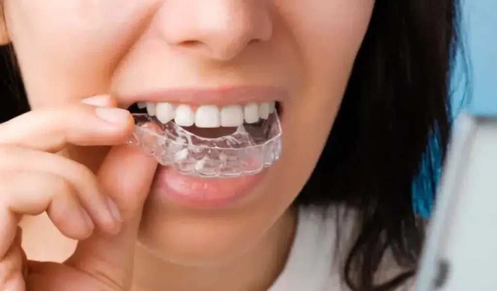 3 Advanced Tools Family Dentists Use To Monitor Early Orthodontic Changes