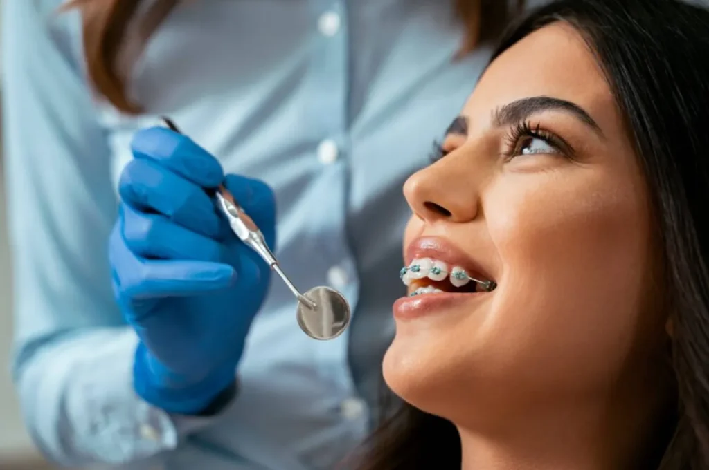 4 Orthodontic Options Commonly Recommended By General Dentists 4 Orthodontic Options Commonly Recommended By General Dentists