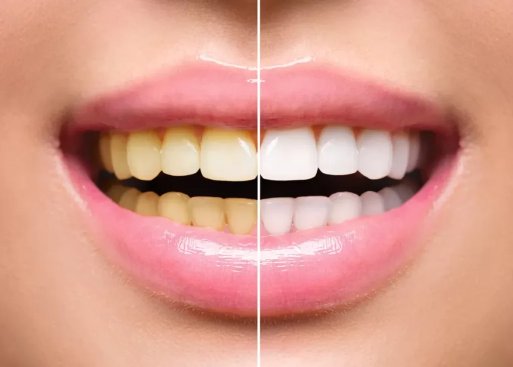 Teeth Whitening, Crowns, And More Cosmetic Services For The Whole Family