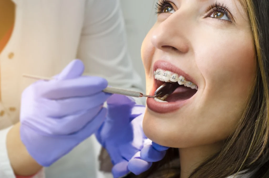6 Tips For Maintaining Oral Hygiene During Orthodontic Treatment