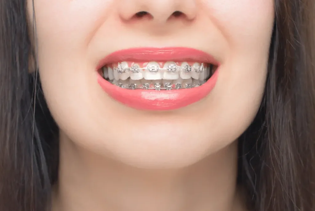 How General And Orthodontic Dentistry Create Confident, Healthy Smiles How General And Orthodontic Dentistry Create Confident, Healthy Smiles